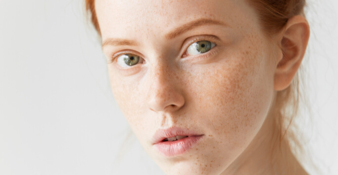 Woman with freckles