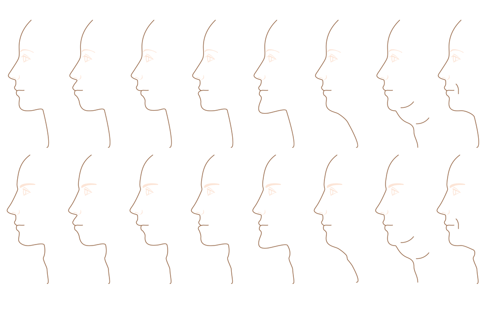 Graph of facial profiles