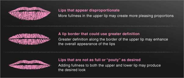 Lips that appear disproportionate, lip border that could use greater definition, lis tha are not as full